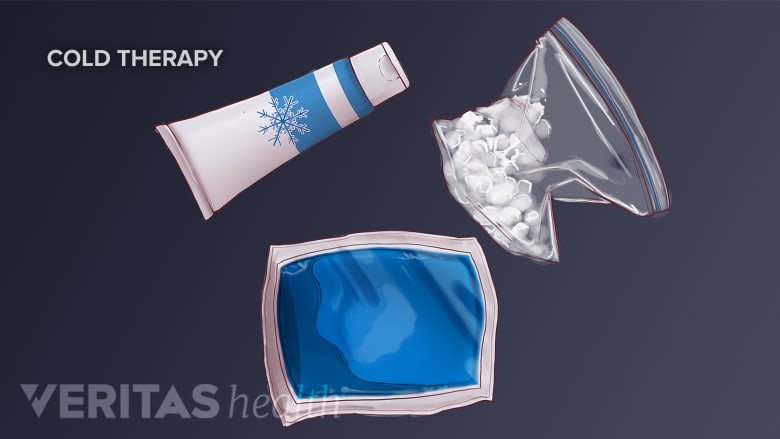 Different types of cold packs.