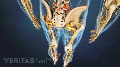 Spondylolisthesis