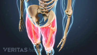 leg pain