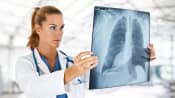 Doctor examining an X-ray of a patient&#039;s lungs and spine.