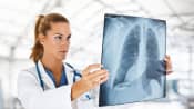 Doctor examining an X-ray of a patient&#039;s lungs and spine.