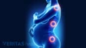 Pregnancy silhouette highlighting back pain points.
