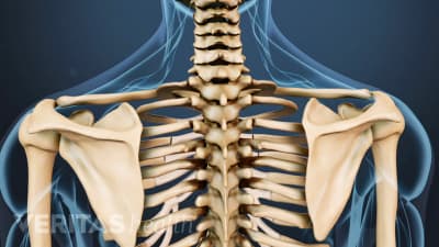 Osteoporosis