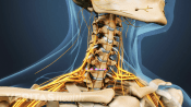 Medical illustration showing the incision point for ACDF surgery in the cervical spine