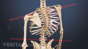 Posterior view of the upper body showing adolescent scoliosis.