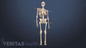 Medical illustration showing the impact of scoliosis on posture