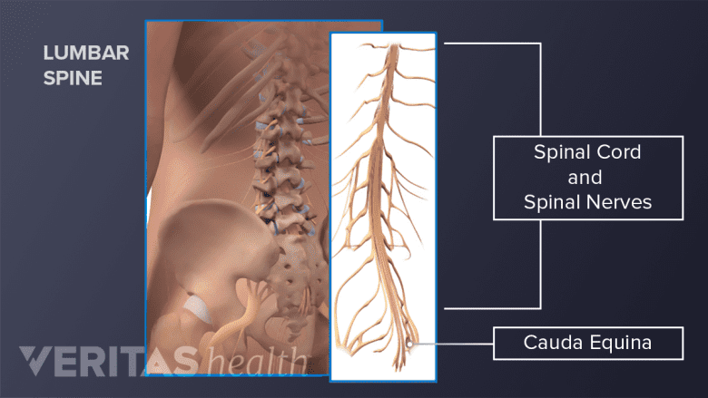 Illustration showing oblique view of the lumbar spine, spinal nerves, and spinal cord.