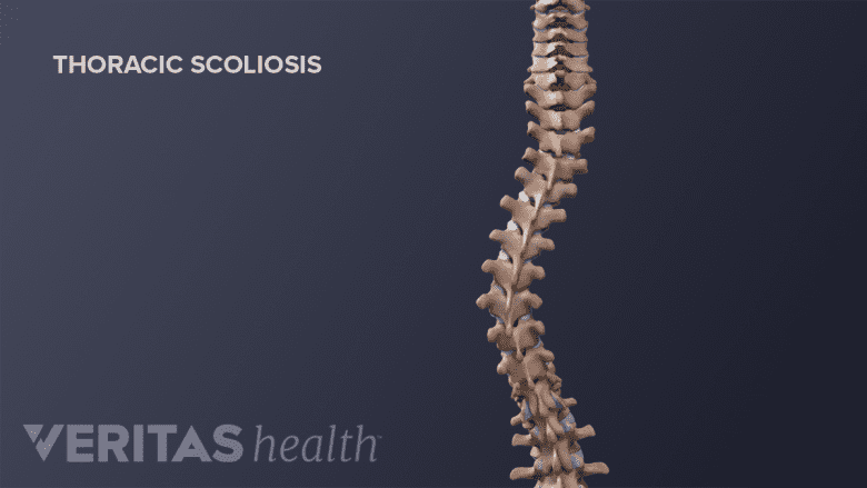 Vertebral spine with a thoracic curvature.