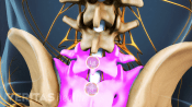 Posterior view of the pelvis highlighting L5 and S1.