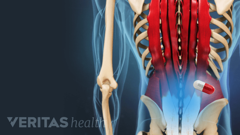 Illustration showing lowback area highlighted in blue with a pill.