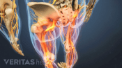 Medical illustration of the lower body showing bones and nerves. The sciatic nerve is highlighted in red, indicating pain, numbness or tingling.