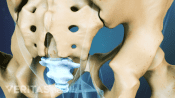 Posterior view of the pelvis highlighting the coccyx.