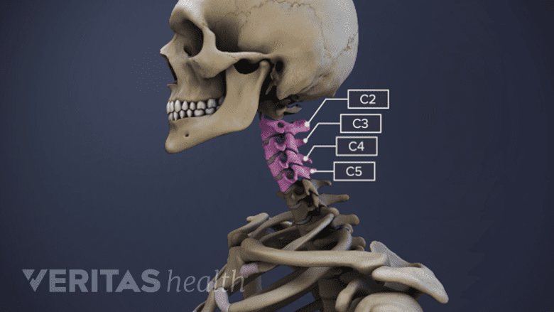 Illustration showing the head, neck and shoulders of a skeleton, with highlights on the c2, c3, c4, and c5 vertebrae