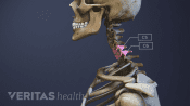 Profile view of the cervical spine with C5-C6 highlighted.