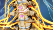 Medical illustration showing the C5-C6 vertebral segment