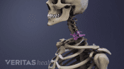Medical illustration of the cervical spine, the C6-C7 vertebrae are highlighted