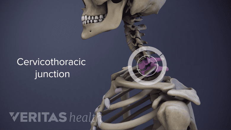 Sagittal view of upper spine with cervicothoracic junction labeled.