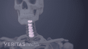 Transparent cervical spine with the discs highlighted.
