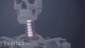 Transparent cervical spine with the discs highlighted.