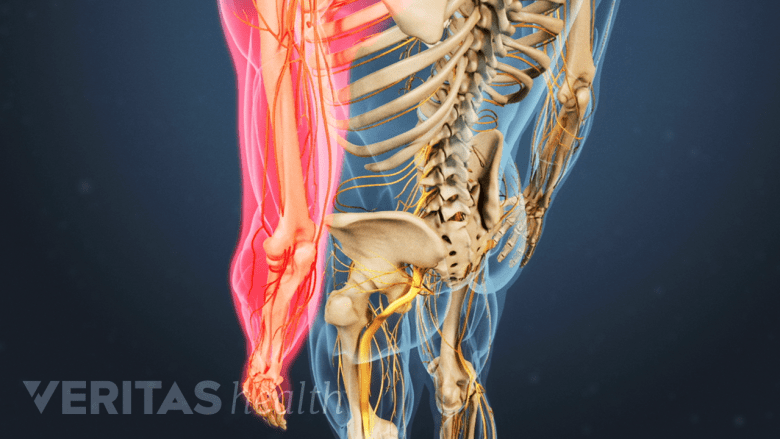 An illustration showing upper body with arm highlighted in red.