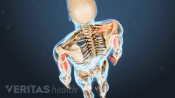 Posterior view of the skeleton showing pain in the body.