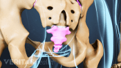 Posterior view of pelvis highlighting the coccyx (tailbone).