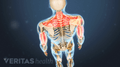 Nerve compression at C-7 cervical spine level