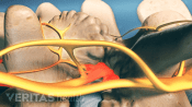 Location of facet joint injections.