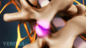 Highlighting pain in the facet joints of the lumbar spine.