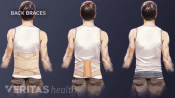 Illustration of corset, lumbar belt, and sacroiliac belt flexible braces for lower back pain