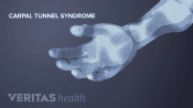 Palmar view of carpal tunnel in the hand