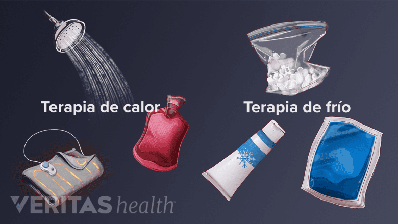 Varios tipos de terapia de frío y calor.