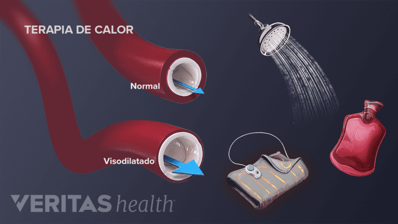 El efecto de la terapia de color sobre los vasos sanguíneos.