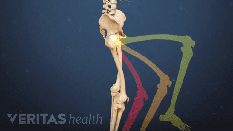 An illustration showing range of motion while lifting the leg.