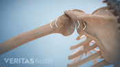 Shoulder cracking with pressure building between bones.