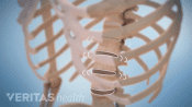 Medical illustration of the lumbar spine showing movement between the vertebrae which often leads to crepitus