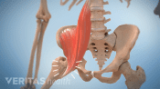 Anterior view of the pelvis showing a crack in the hip joint.