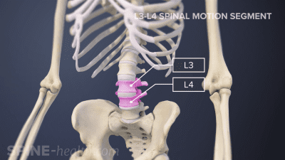 Highlighting L3-L4 spinal segment level in the lumbar spine.