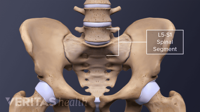 Anterior view of the L5-S1 Spinal Segment
