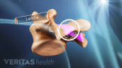 Profile view of vertebra highlighting the lamina.