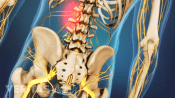 Lower Back Strain