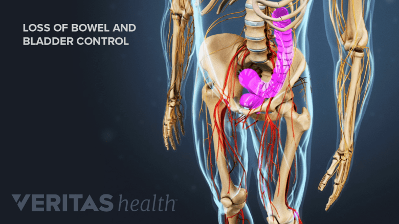 Illustration showing pelvis with bowel and bladder highlighted in red.