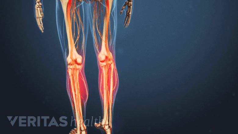 Medical illustration of a skeleton. The shins are highlighted in red.