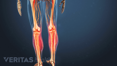 Medical illustration of a skeleton. The shins are highlighted in red.