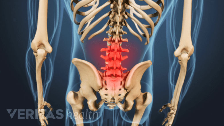 Illustration showing posterior torso with red highlight in the low back region.