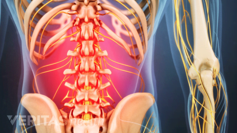 An illustration showing an adult spine with low back muscles highlighted in red.