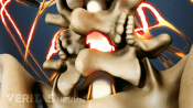 Medical illustration of the spinal cord going through the spinal column. It is highlighted in red to indicate pain, numbness or tingling.