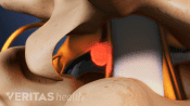 Closeup view of the spinal cord in the spinal canal