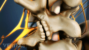Spinal stenosis in the lumbar spine