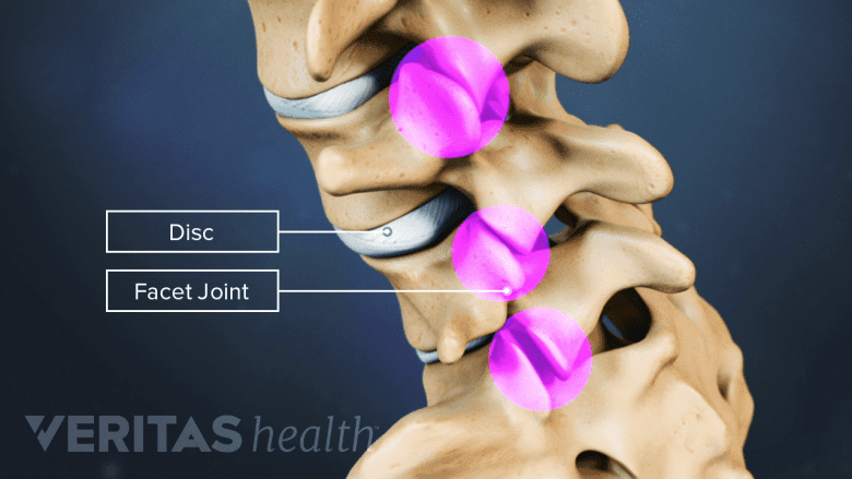Illustration showing  lumbar vertebrae with a red highlight in the disc area.